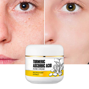 Crema facial de cúrcuma y vitamina C con ácido salicílico y <span class=keywords><strong>aloe</strong></span> <span class=keywords><strong>vera</strong></span> calmante Control de aceite calmante alivio del acné brillo OEM listo - Product Image 1