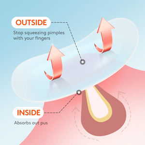 Forma personalizada Estrellas de colores Hidrocoloide Acné Imperfecciones Parches para espinillas Parches para el acné Etiqueta privada - Product Image 6