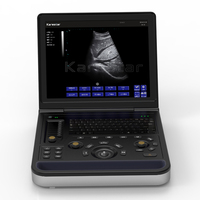 Scanner à ultrasons portable à faible coût de 15 pouces Système de diagnostic médical vétérinaire Échographie échographique