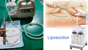 <span class=keywords><strong>Pompa</strong></span> per Liposuzione Assistita da Laser 980nm 1470nm, Aspiratore per Perdita di <span class=keywords><strong>Grasso</strong></span> con Fibra Medicale, Macchina per Aspirazione a Vuoto ad Alta Potenza con Bottiglie - Product Image 4