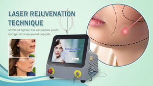 טיפול להמסת שומן באמצעות לייזר דיודה 980 ננומטר, להפחתת שומן בסנטר כפול, מרפאת ניתוחים פלסטיים - Product Image 6