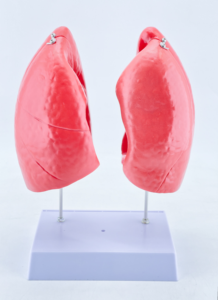 Human Lung Anatomy Model With Colored Bronchi For Educational Use - Product Image 5
