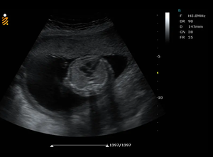 Mesin <span class=keywords><strong>Ultrasound</strong></span> Doppler warna berbasis troli baru 2024 untuk rumah sakit pemindai gema 15 inci - Product Image 5