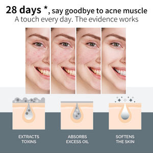 OEM Améliore lacné et les points noirs, <span class=keywords><strong>masque</strong></span> nettoyant en profondeur et détoxifiant - Product Image 4