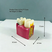 Modèle de section transversale dentaire avec grossissement 6X pour l'analyse des caries en clinique