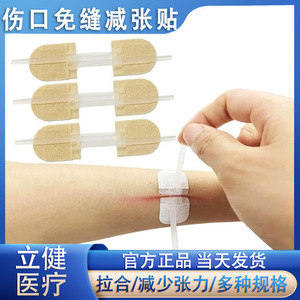 Pansement adhésif médical d'urgence pour la fermeture des plaies, 45 mm x 10 mm, avec fermeture éclair pour la réduction de la tension, pour usage extérieur - Product Image 5