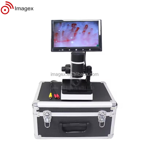 Capilaroscopio de Uñas Portátil, Instrumento Óptico, Sistema de Capilaroscopia de Uñas para Diagnóstico de Microcirculación - Product Image 1