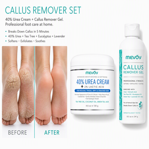 Gel Rimuovi Calli Extra Forte OEM di Grado Professionale per Talloni Secchi e Screpolati, Rimozione <span class=keywords><strong>Pelle</strong></span> Morta, Pedicure da Salone per Piedi a Casa - Product Image 3