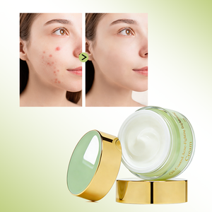 Crème Réparatrice Anti-Acné et Anti-Imperfections pour le Visage avec Extrait d'Arbre à Thé et de Centella Asiatica, Contrôle du Sébum et <span class=keywords><strong>Acide</strong></span> Salicylique - Product Image 3