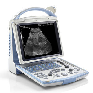 Mesin <span class=keywords><strong>Ultrasound</strong></span> Mindray Dp 10 Ecografo Portabel 3d Mindray Ultrasonido - Product Image 3