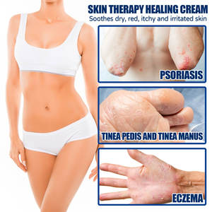 Krim Kecantikan dan Perawatan Kulit Salep <span class=keywords><strong>Psoriasis</strong></span> untuk Pengobatan Krim <span class=keywords><strong>Herbal</strong></span> untuk Perawatan Eksim Perawatan Perbaikan Kulit - Product Image 4