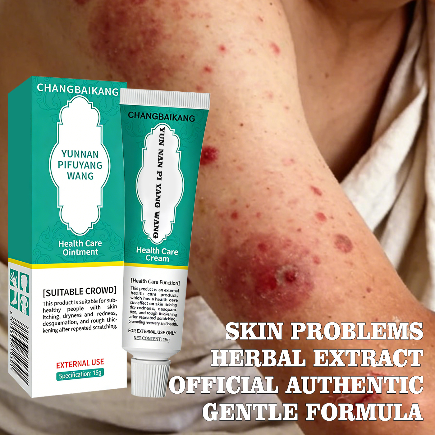 Intolerable itching on the body. Herbal ointment for natural external use