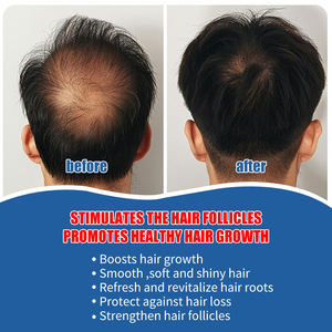 Creme de Ervas Personalizado OEM para Recrescimento Capilar e Sérum para Cuidado do Couro Cabeludo com Função Reparadora - Product Image 2