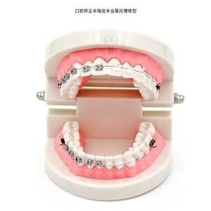 Modelo Dental de Ortodoncia, Brackets Semi-Cerámicos Semi-Metálicos, Implante de Plástico, Prótesis para la Comunicación Médico-Paciente y la Enseñanza - Product Image 4