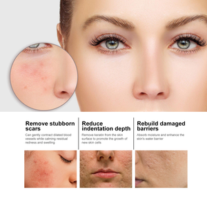 <span class=keywords><strong>Y</strong></span> esencia Facial de ácido hialurónico reparación profunda HIDRATANTE PIEL Facial esencia antienvejecimiento productos coreanos para el cuidado de la piel - Product Image 4