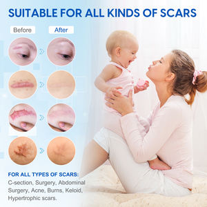 ELBBUB Private Label 1.5m Reparação Cicatrizes Cirúrgicas Keloid À Prova D' Água Folha De Cicatriz Reutilizável Remendos De Fita De Remoção De Cicatriz - Product Image 5