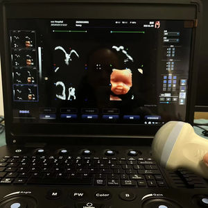 Échographe Doppler Couleur Portable pour Hôpital, Meilleur <span class=keywords><strong>Prix</strong></span>, Appareil d'Échographie Humaine 3D <span class=keywords><strong>4D</strong></span> Portable pour Grossesse - Product Image 1