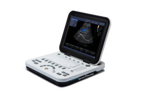 Échographe vétérinaire portable Kaixin KU1 pour le diagnostic de gestation des animaux d'élevage, alimenté par batterie, pour grands animaux - Product Image 2