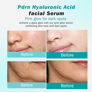 Suero Facial de Ácido Hialurónico PDRN de Marca Privada, Hidratación Profunda para Aliviar el Enrojecimiento, Mantenimiento de la Estabilidad, Reparación de la Piel Frágil, Suero OEM - Product Image 2