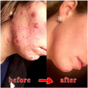 สบู่โคจิกแอซิดทำมือ 7 วัน ผิวกระจ่างใส เรียบเนียน ทำความสะอาดผิวหน้าและผิวกาย - Product Image 6