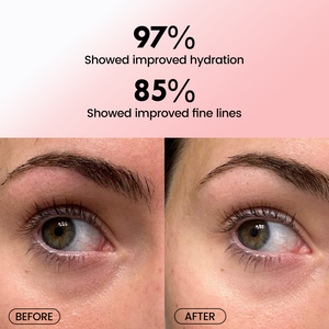 Masque pour les <span class=keywords><strong>yeux</strong></span> de marque privée or rose patchs sous les <span class=keywords><strong>yeux</strong></span> pour éliminer les cernes rides coussinets de gel pour les <span class=keywords><strong>yeux</strong></span> - Product Image 3