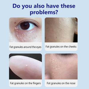 DERMFREE 30ml cairan Herbal alami untuk penghilang lemak butiran kulit halus & pelindung Milia bintik-bintik Perawatan Tubuh - Product Image 4