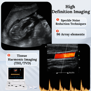 Mindray Z60Vet sistema diagnostico a ultrasuoni a colori Doppler veterinario trasduttore Scanner macchina a ultrasuoni - Product Image 2