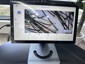 Analyseur de cuir chevelu intelligent AI, machine d'analyse capillaire, détecteur numérique de follicules pileux, microscope HD, <span class=keywords><strong>scanner</strong></span> de cuir chevelu pour salon et clinique - Product Image 4