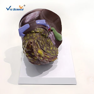 แบบจำลองทางกายวิภาคของตับที่เป็นโรค 4 ขั้นตอน ทำจาก PVC สำหรับการฝึกอบรมทางวิทยาศาสตร์การแพทย์ในโรงพยาบาล โดย VIC-SCIENCE - Product Image 1