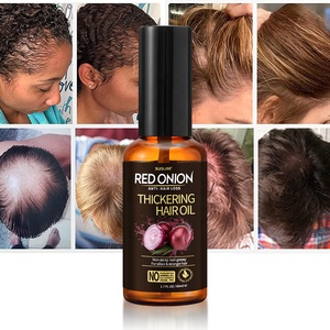 زيت سيروم نمو الشعر للعناية بالشعر من علامة OCCA التجارية الخاصة، عضوي، نباتي، طبيعي لفروة الرأس، لعلاج تساقط الشعر، بزيت الأرغان والخروع والبصل الأحمر، للبيع بالجملة - Product Image 6