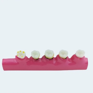 Modèle pédagogique d'hygiène bucco-dentaire : Manuel, caries dentaires, accessoires de soins dentaires, équipement de thérapie orale - Product Image 6