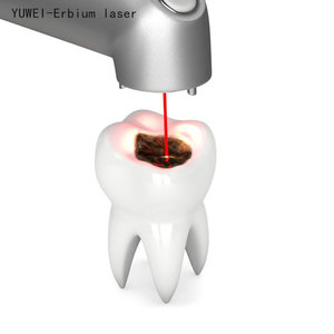 Máy Hàn nha khoa và chỉnh nha Yag laser tại chỗ thợ hàn cho hàm răng giả sửa chữa erbium Laser Er YAG - Product Image 4