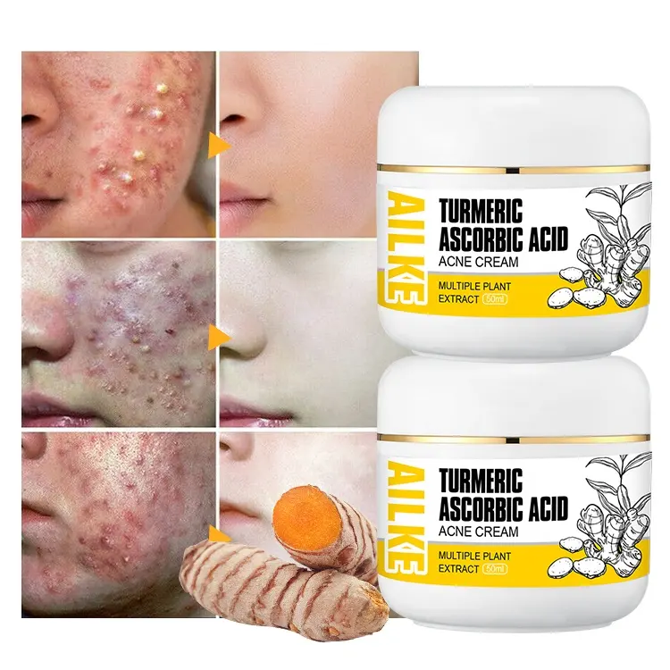 Penghapusan Herbal OEM untuk membersihkan bekas luka dan Jerawat terbaik pemutih wajah Anti pengobatan krim jerawat untuk semua jenis kulit