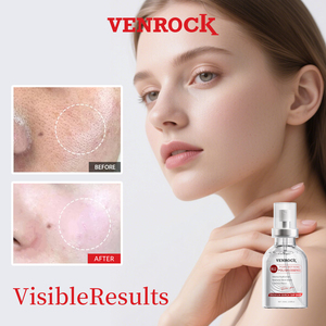 Essence Raffinante aux Pores de Niacinamide : Réduit les Pores, Contrôle le Sébum, Éclaircit, Élimine les Points Noirs, Hydratation Profonde, Lisse la Peau, Extrait de Saule - Product Image 1