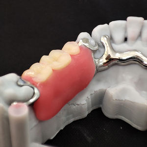 Échantillon gratuit Prothèses dentaires partielles amovibles Chine Laboratoire <span class=keywords><strong>dentaire</strong></span> Impression 3d Co Cr Alliage Cadre métallique - Product Image 2