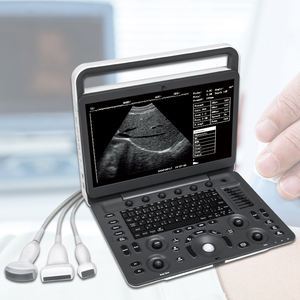 SonoScape E2 Ultrasonik Kualitas Tinggi dengan Sensor Ultrasonik - Product Image 4