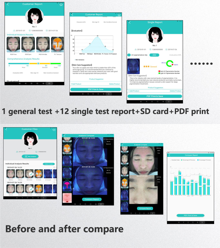 Skin Wrinkle Professional Skin Analyzer Machine With Tablet