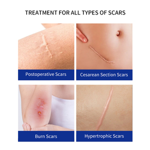 Gel cicatrisant en silicone haute performance pour le visage et le corps, efficace sur les vergetures, les cicatrices chirurgicales, l'acné et les cicatrices anciennes/nouvelles - Product Image 5