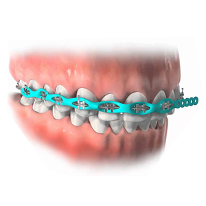 Guber 치과용 엘라스토메릭 파워 체인 스풀 롱타입 교정용 고무줄 - Product Image 4