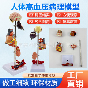 Modelo de hipertensión/presión arterial; Modelo de diabetes/visceras patológicas; Presión arterial patológica; Cerebro; Ojo; Corazón; Riñón; - Product Image 4