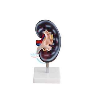 Modèle pédagogique de l'anatomie du rein humain HC-S266, structure rénale - Product Image 2