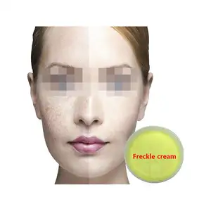 Nha Cung Cap Dong Nam A Eliminar las ojeras Perla Aloe Vera Eliminar Melasma Blanqueamiento Crema para pecas