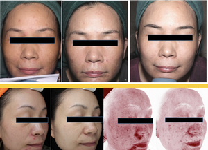 Personalización disponible Cambios DE LA PIEL Comparando enfermedades de la piel Diagnóstico Futuro envejecimiento Analizador de predicción de la piel - Product Image 2