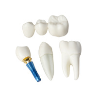 Modèle Anatomique Détachable en Résine pour Prothèses Dentaires et Implants – Usage Hospitalier, Universitaire et Médical – YUYUE