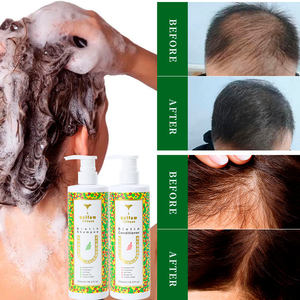 Custom Organic Tea Tree <span class=keywords><strong>Oil</strong></span> Cebola e Alecrim Hair Care Crescimento Shampoo Biotina Herbal Shampoo e Condicionador Set Private Label - Product Image 3