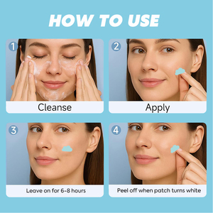 Toppa dell'<span class=keywords><strong>acne</strong></span> idrocolloide a forma di nuvola blu chiaro 4 toppe <span class=keywords><strong>Per</strong></span> foglio in custodia a specchio d'argento - Product Image 6