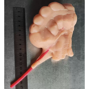 Kyrenmed 3D Ruột Thừa mô hình với 2mm hoặc 5mm mô phỏng mạch máu nội soi phẫu thuật đào tạo mô phỏng - Product Image 4