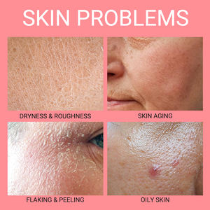 Sérum Marque Blanche Mousse Nettoyante Crème Visage Hydratante Crème Visage Crème à la Rose Soin Visage Set Rose Set Soin de la Peau - Product Image 6