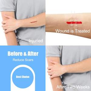 60mm x 195mm berpakaian perekat kupu-kupu steril dapat dipotong untuk penutup Luka 10 buah perangkat penutup luka darurat - Product Image 5