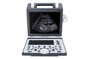 Ecógrafo Doppler Color Portátil Veterinario SIUI Apogee 2300, Máquina de Ultrasonido 4D para Hospitales de Mascotas y Animales - Product Image 4